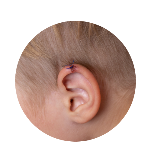 laceration stitched at urgent care 